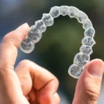 Invisalign Warszawa