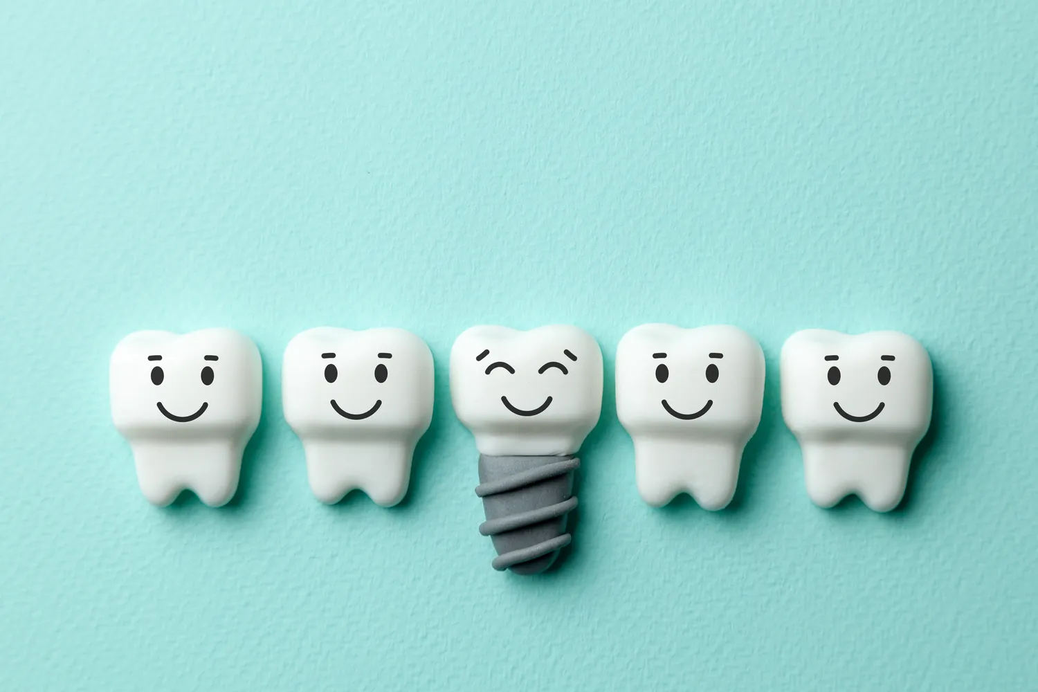 Implanty zębów – ile kosztuje wstawienie zęba?