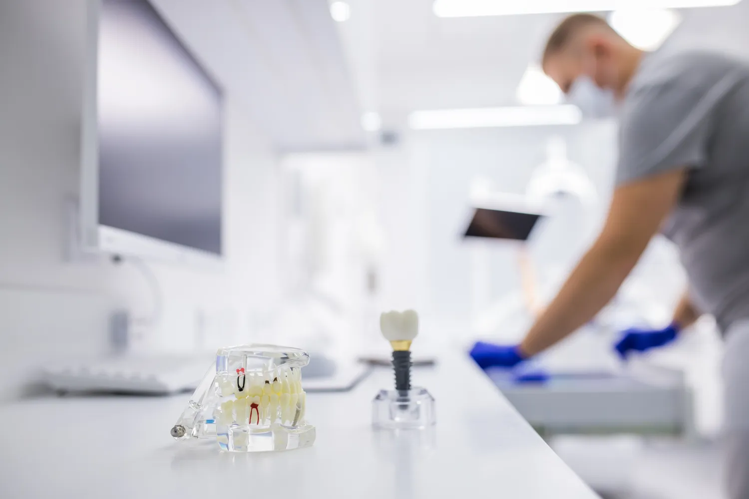 Rodzaje implantów zębowych